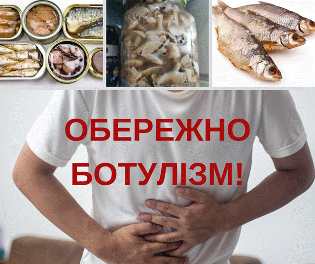 Ботулізм: що варто знати?