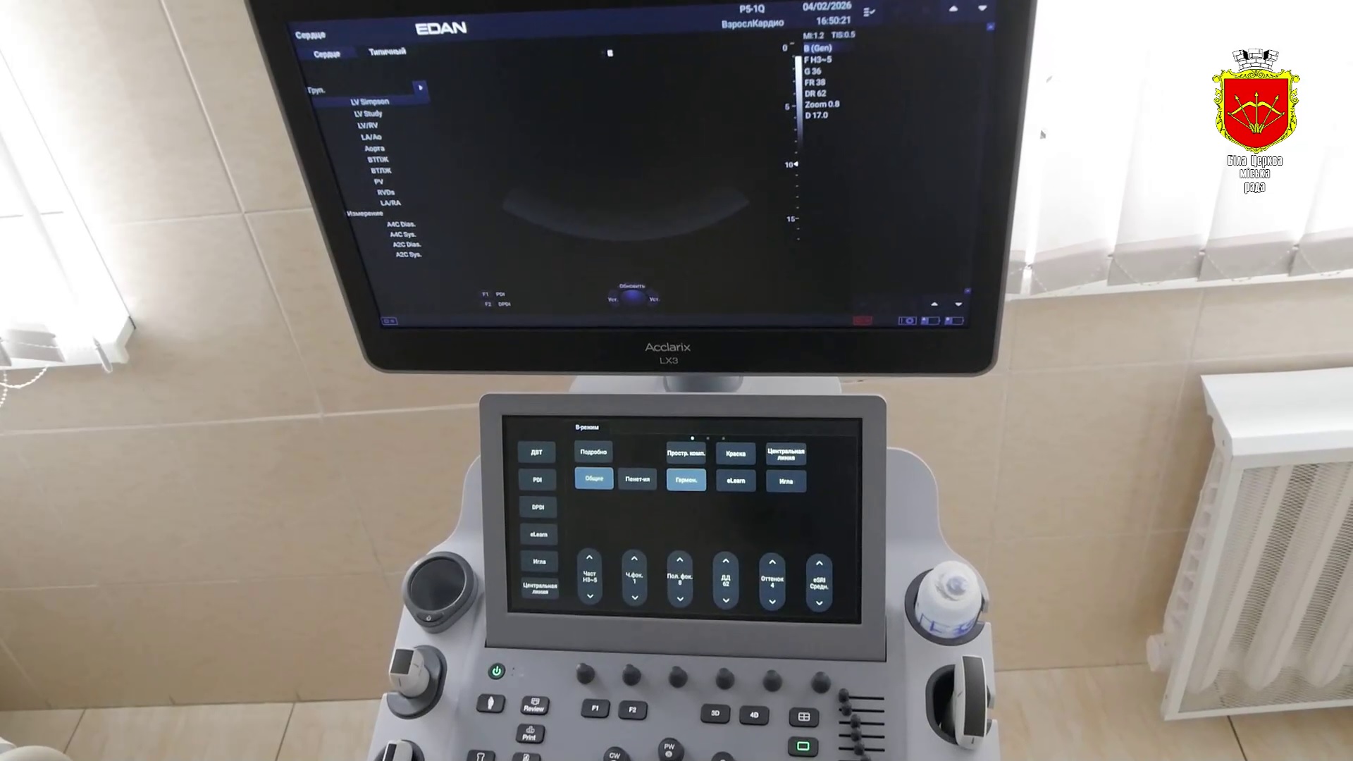 УЗД-апарат інсультного відділення міської лікарні №2 дає змогу виграти час для пацієнтів з інсультом та інфарктом міокарда